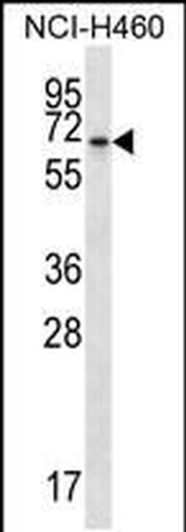 BEND4 Antibody in Western Blot (WB)