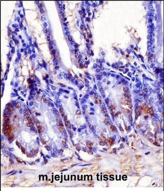 HOXB7 Antibody in Immunohistochemistry (Paraffin) (IHC (P))