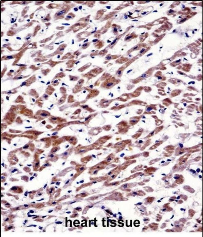 MOV10 Antibody in Immunohistochemistry (Paraffin) (IHC (P))