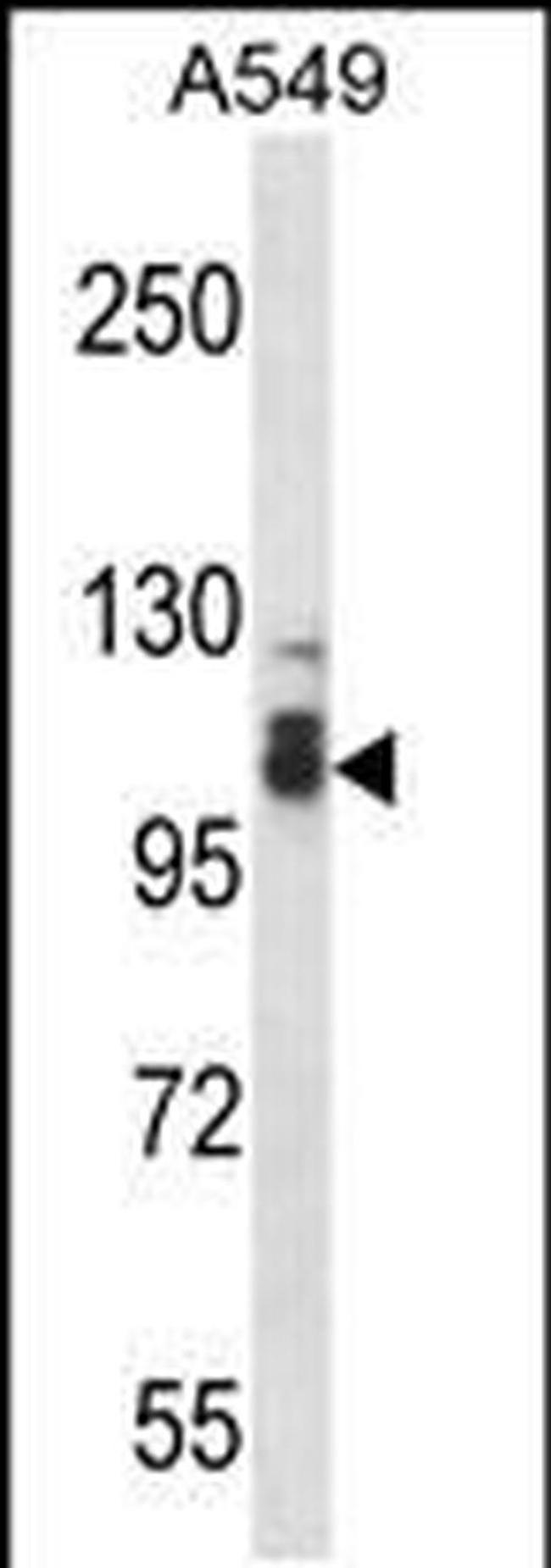 SMEK2 Antibody in Western Blot (WB)