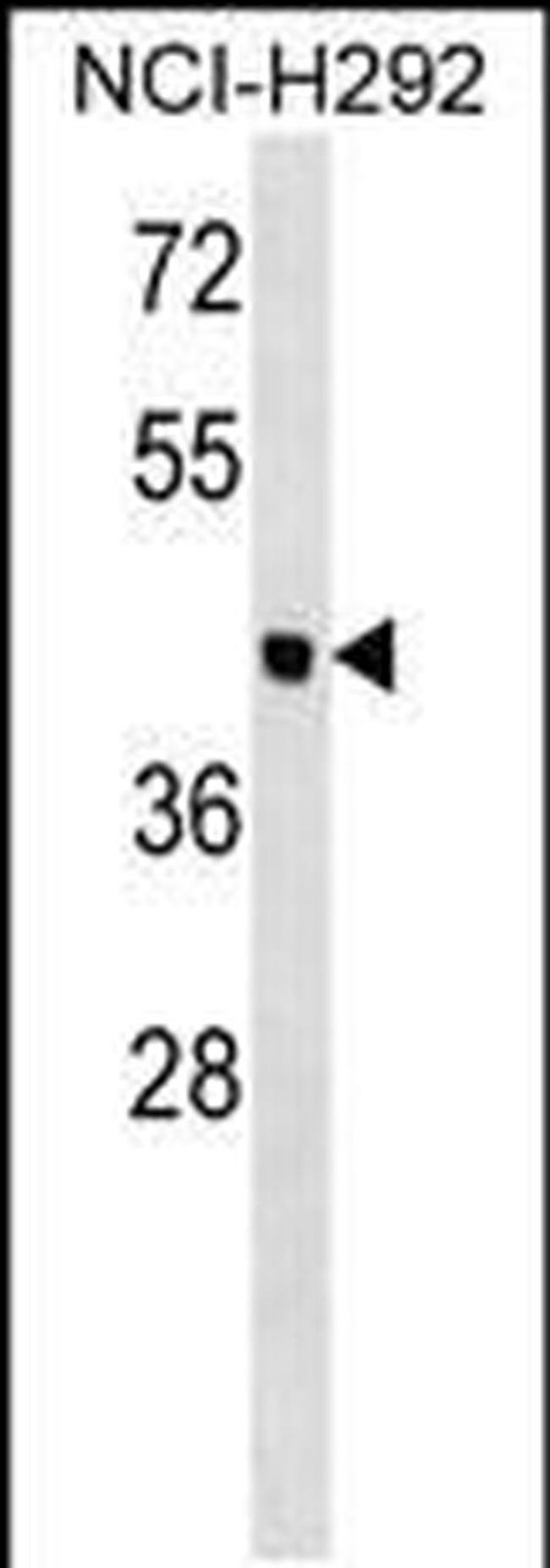 OTOL1 Antibody in Western Blot (WB)