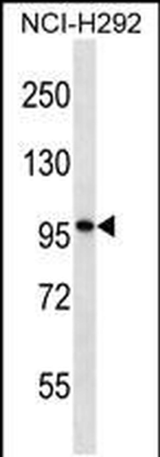 PTCHD2 Antibody in Western Blot (WB)