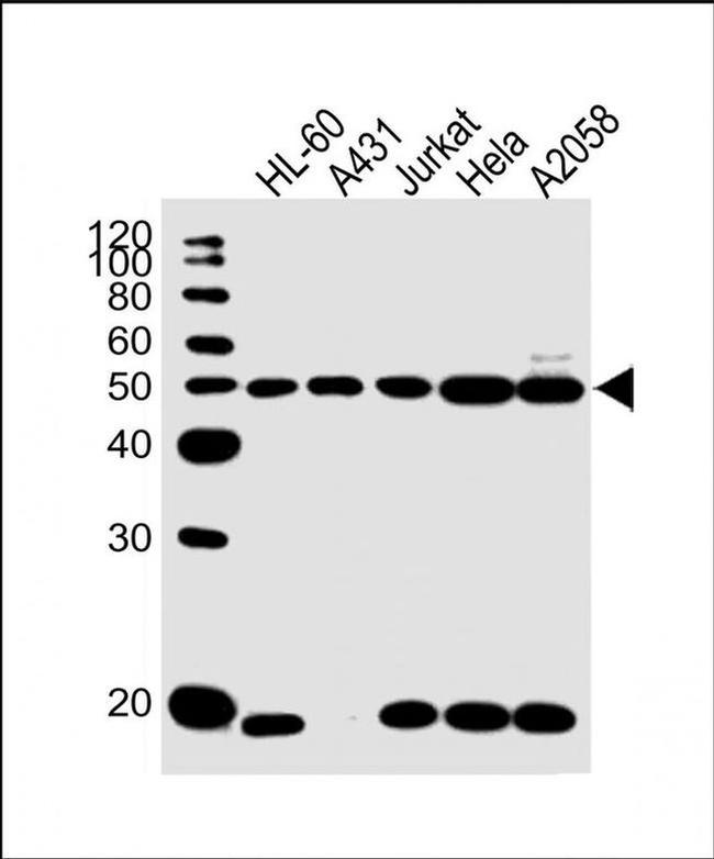 KRT28 Antibody in Western Blot (WB)