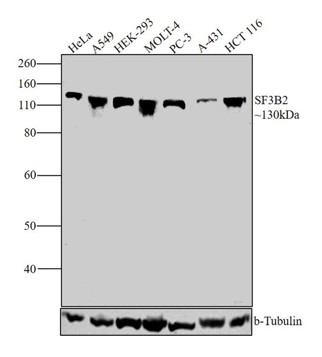 SF3B2 Antibody in Western Blot (WB)