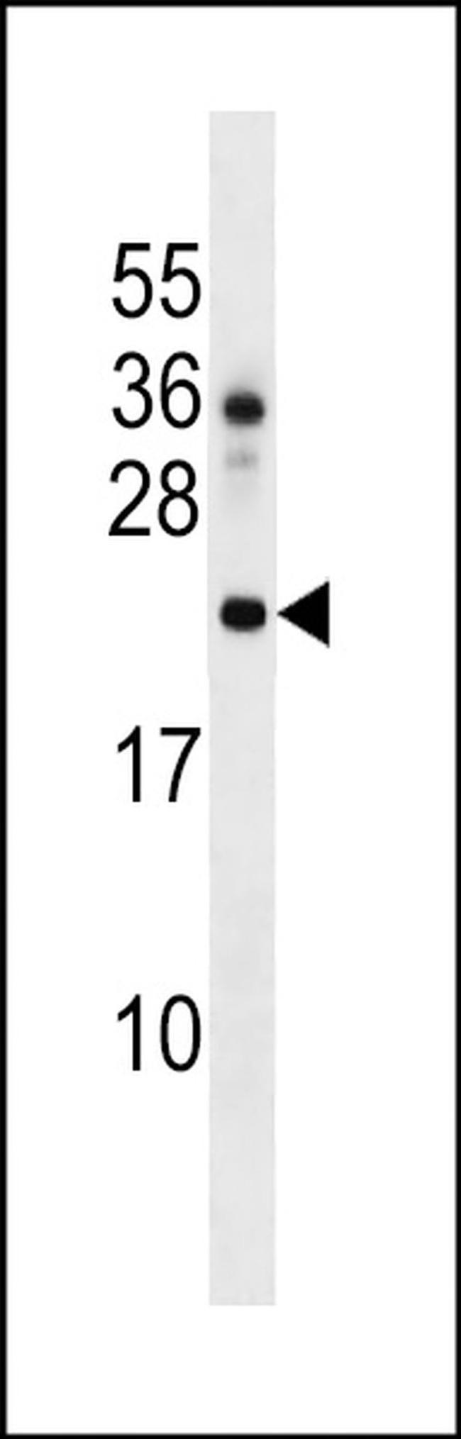 DNAJC24 Antibody in Western Blot (WB)