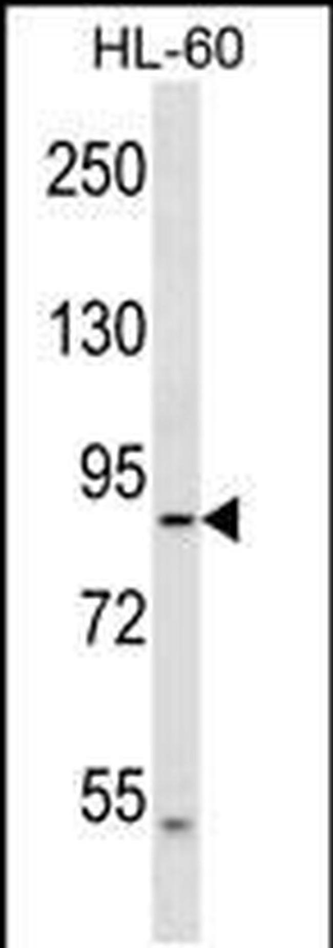 DNAH2 Antibody in Western Blot (WB)