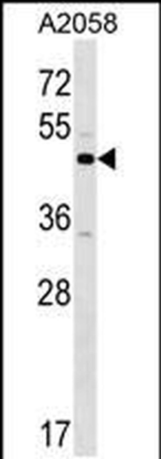 XKR3 Antibody in Western Blot (WB)