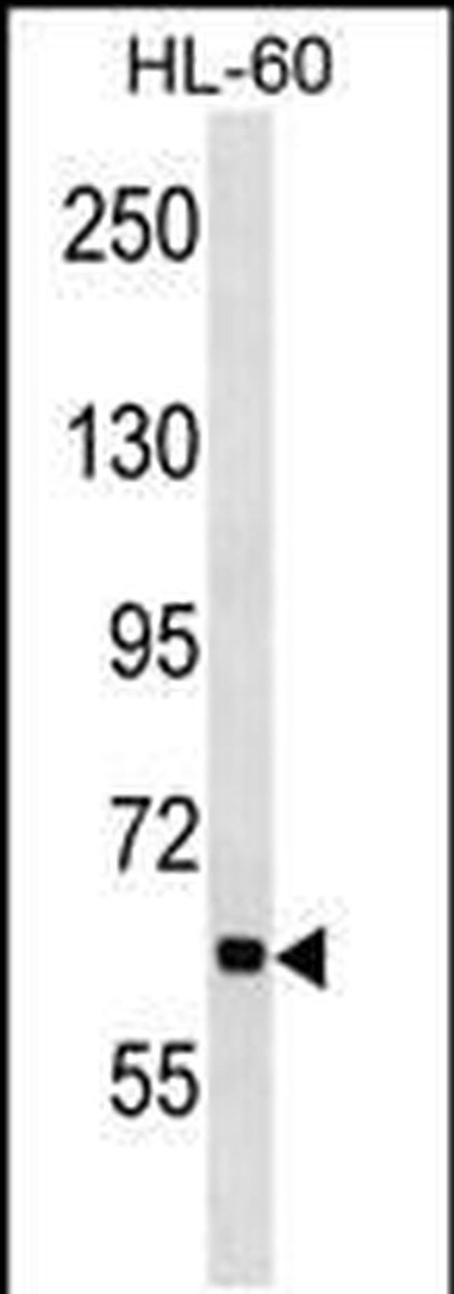 ANKHD1 Antibody in Western Blot (WB)