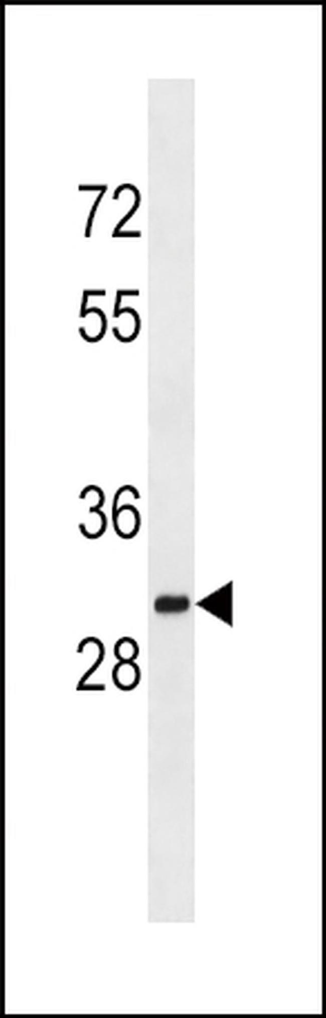 SULT1A2 Antibody in Western Blot (WB)
