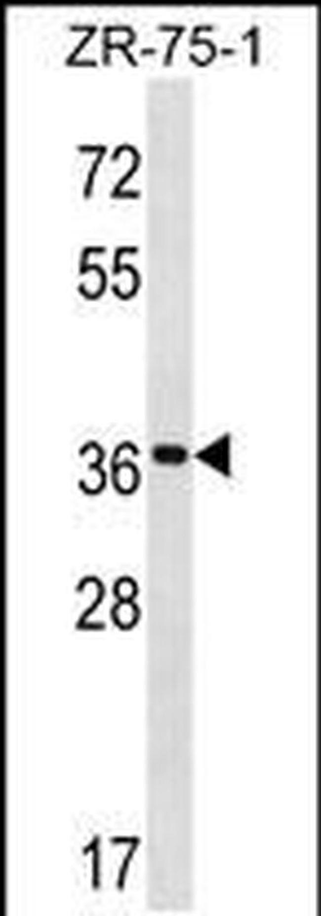 FUT7 Antibody in Western Blot (WB)