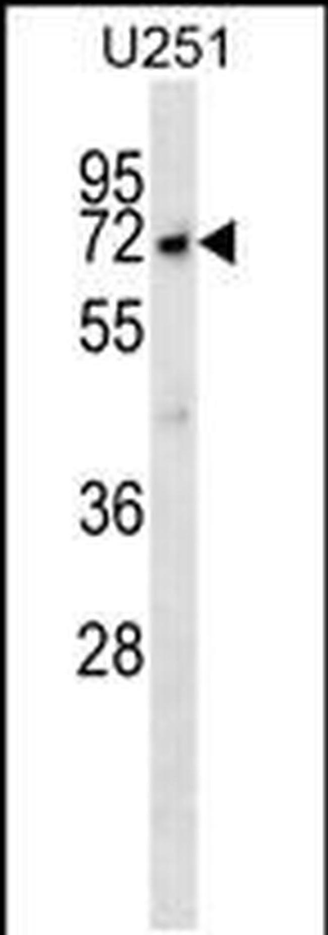MKKS Antibody in Western Blot (WB)