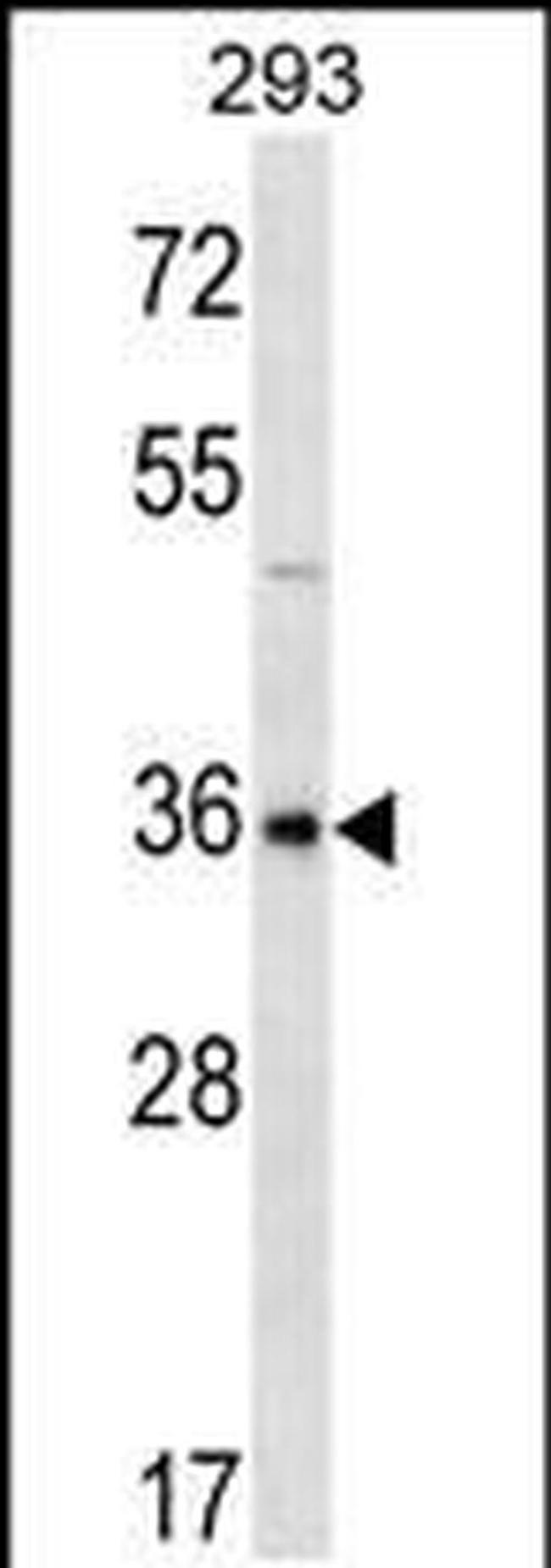 GBX1 Antibody in Western Blot (WB)