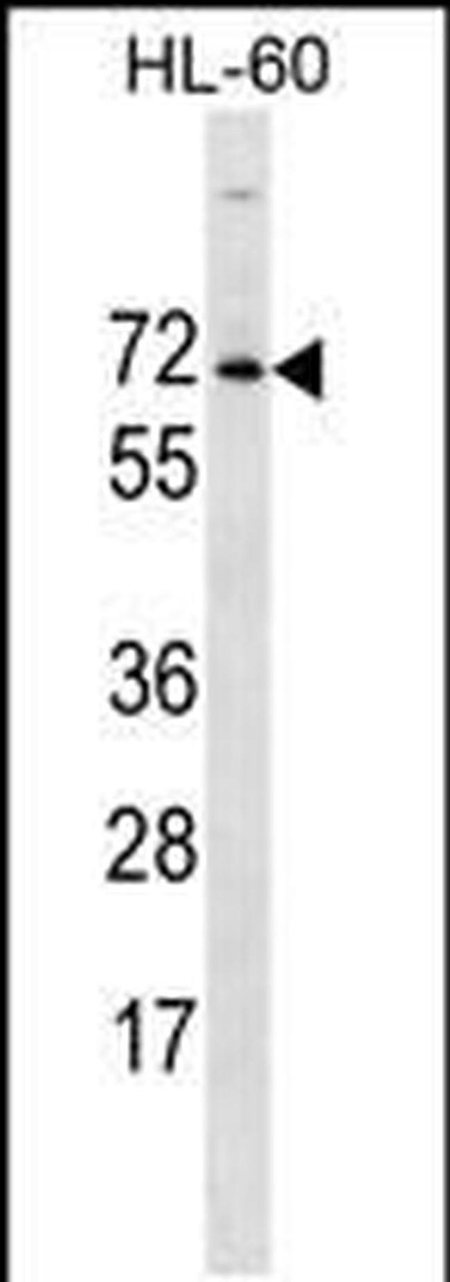 ACPL2 Antibody in Western Blot (WB)