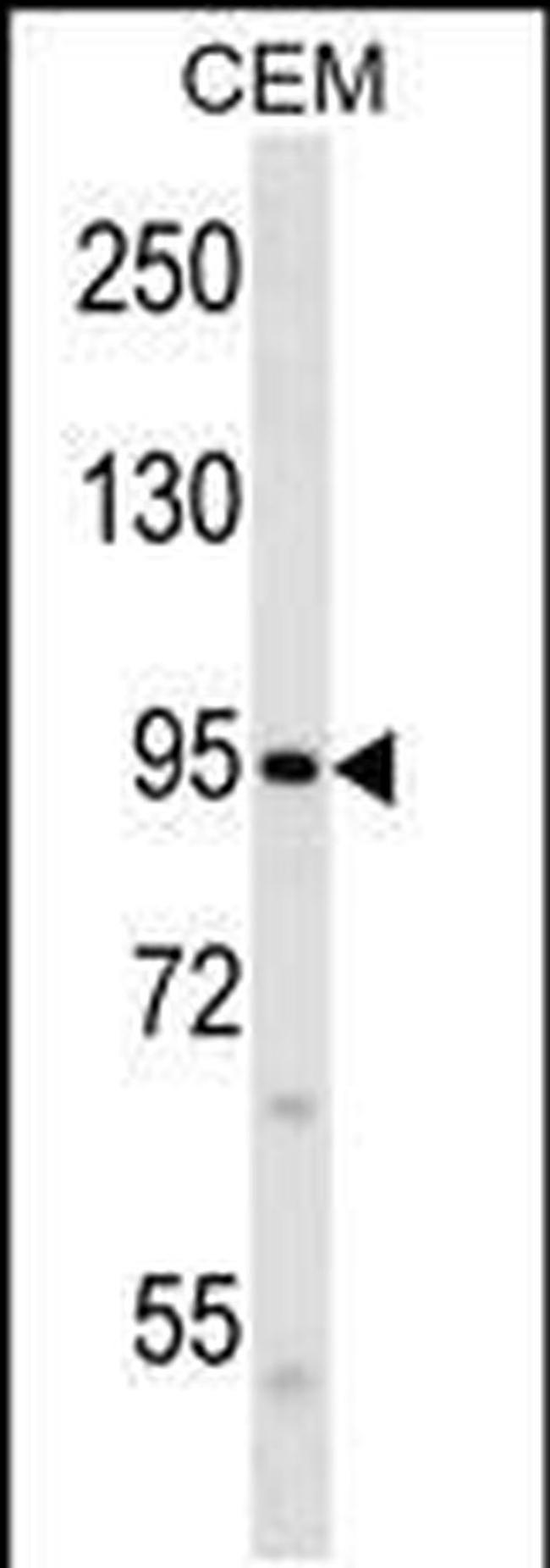 PIEZO2 Antibody in Western Blot (WB)