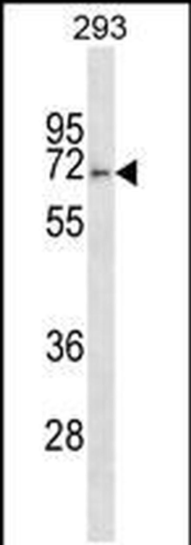 FBXO46 Antibody in Western Blot (WB)