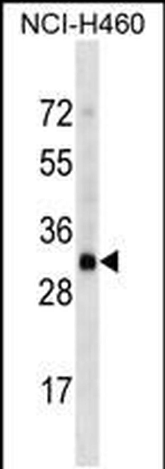 OR4D2 Antibody in Western Blot (WB)