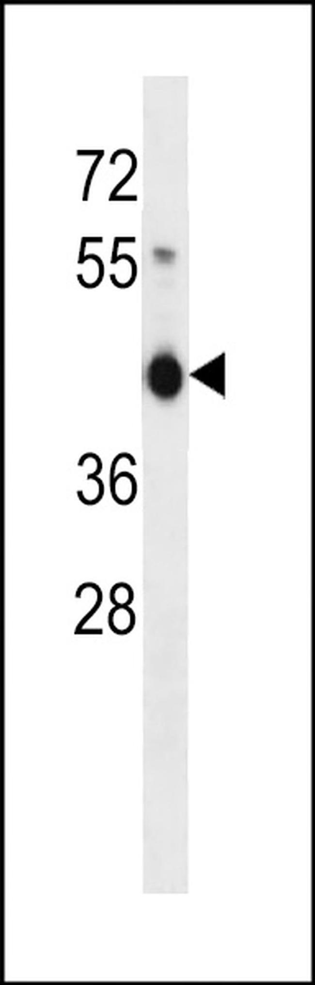 ZNF843 Antibody in Western Blot (WB)
