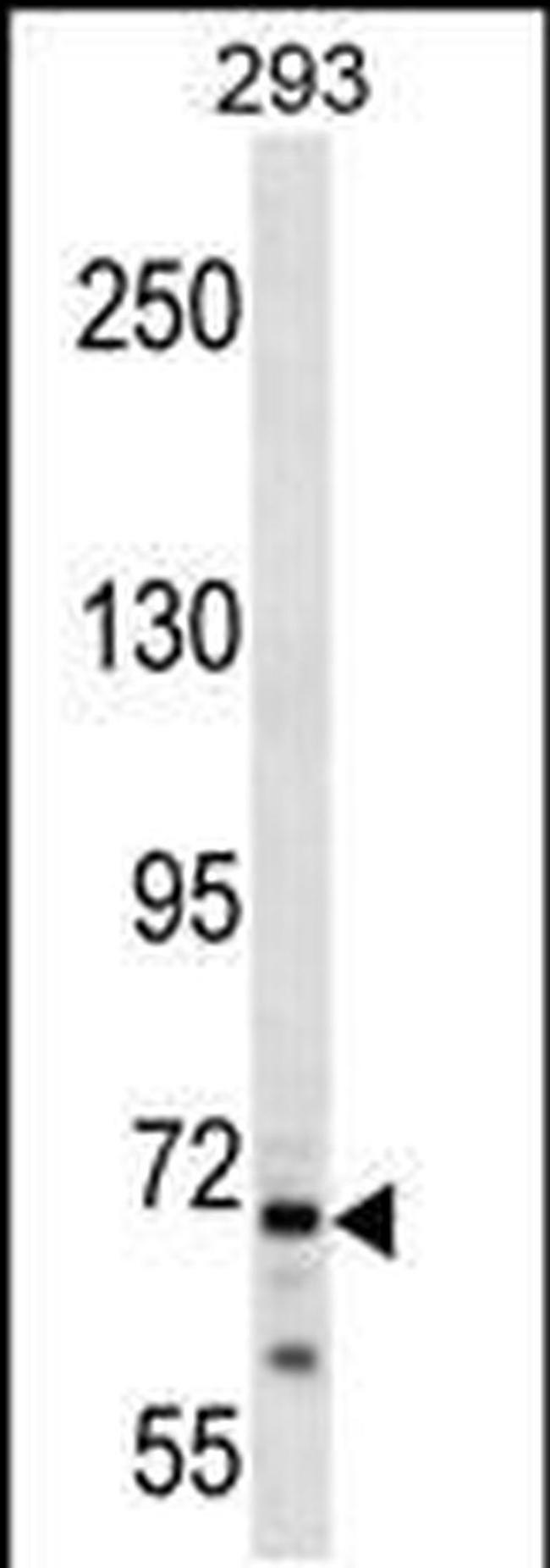 CEP72 Antibody in Western Blot (WB)