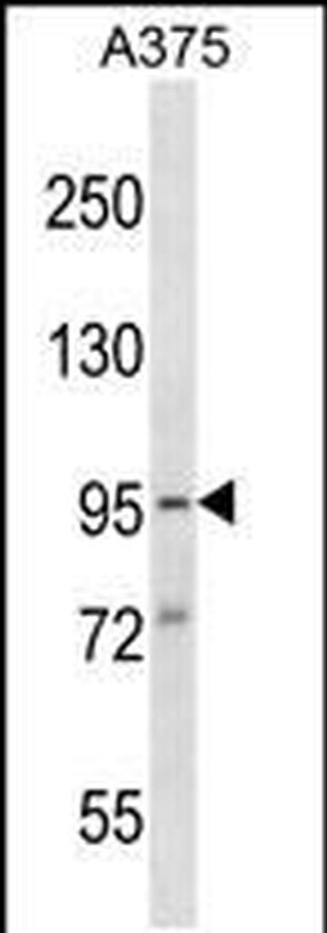 SYDE1 Antibody in Western Blot (WB)