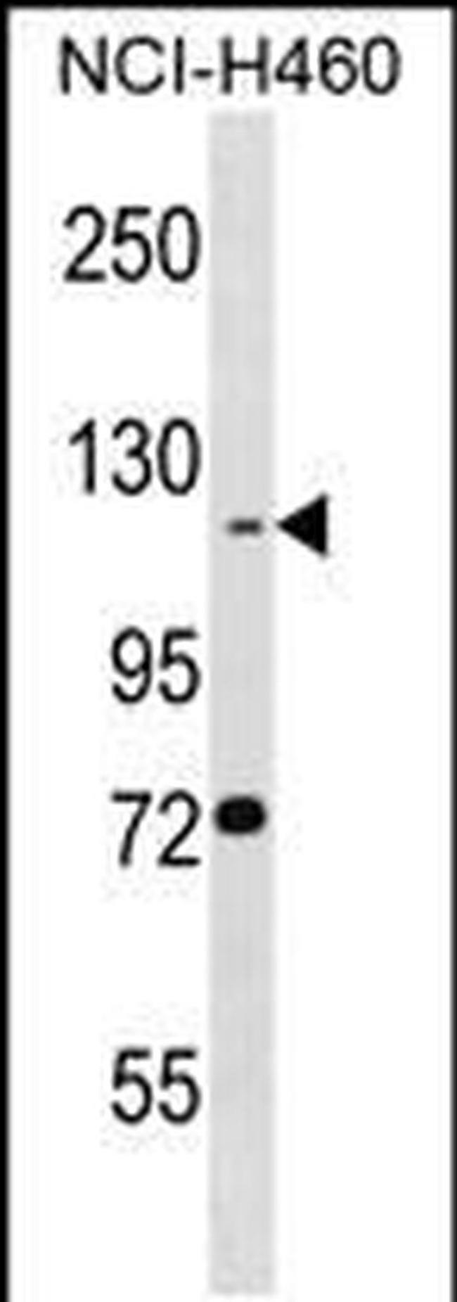 BEND3 Antibody in Western Blot (WB)