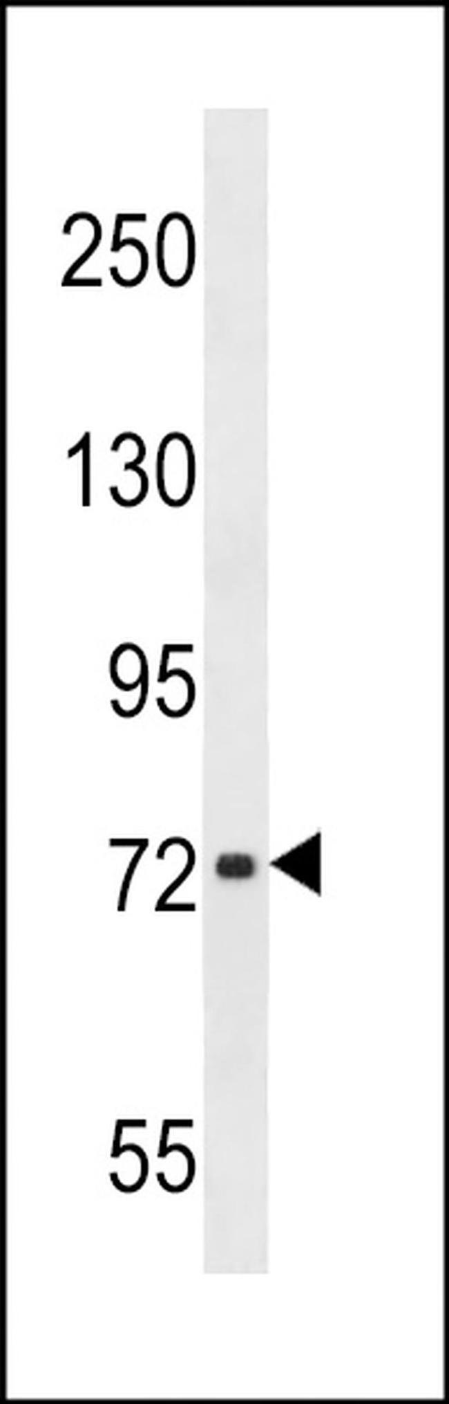 CHADL Antibody in Western Blot (WB)