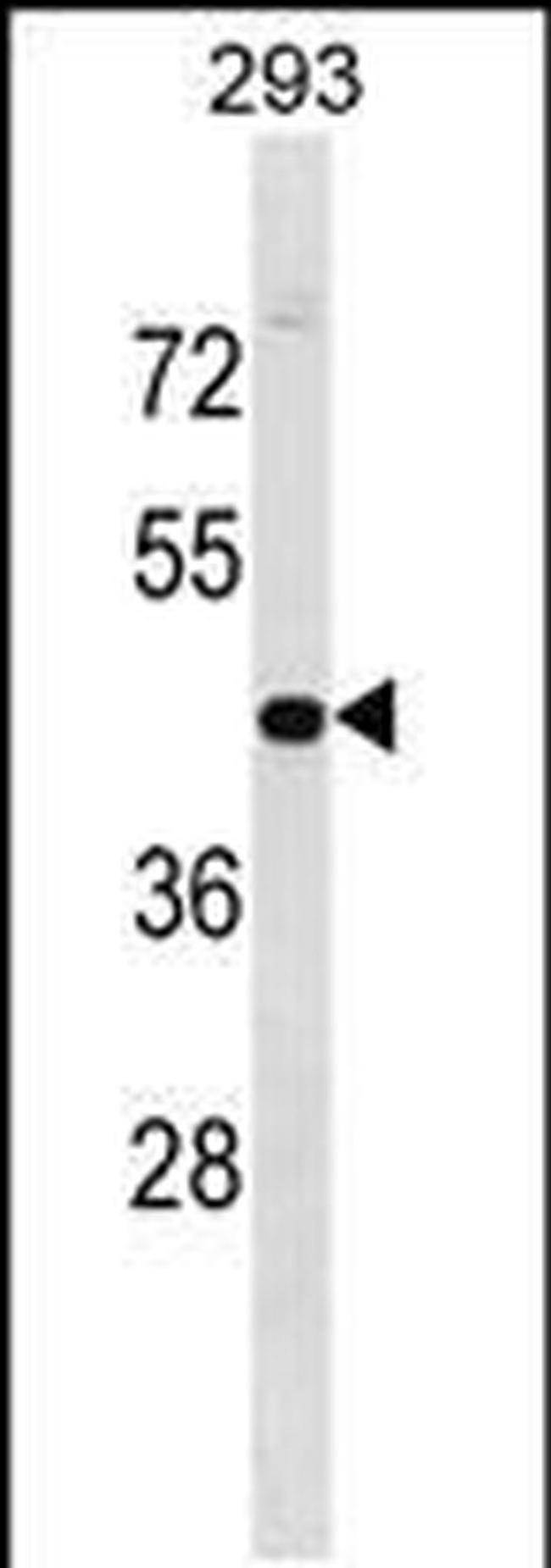 GPN1 Antibody in Western Blot (WB)