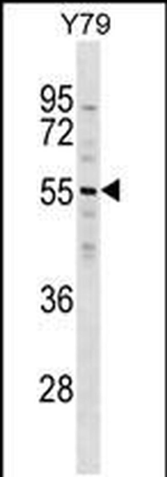 ZNF620 Antibody in Western Blot (WB)