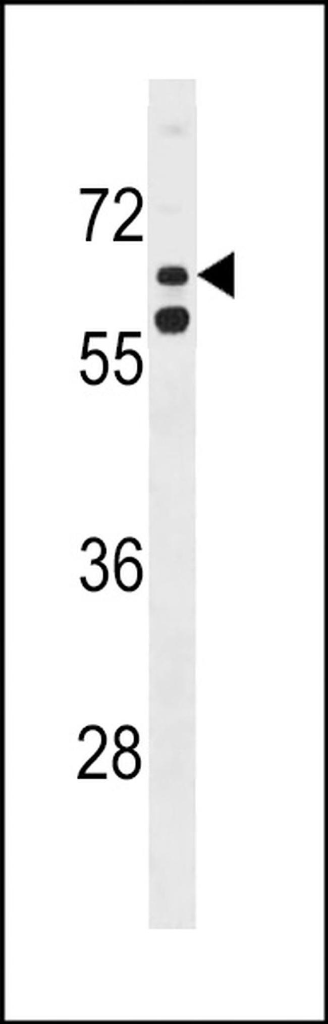 KLHL38 Antibody in Western Blot (WB)