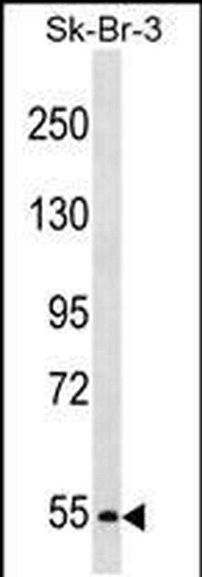 PCSK4 Antibody in Western Blot (WB)