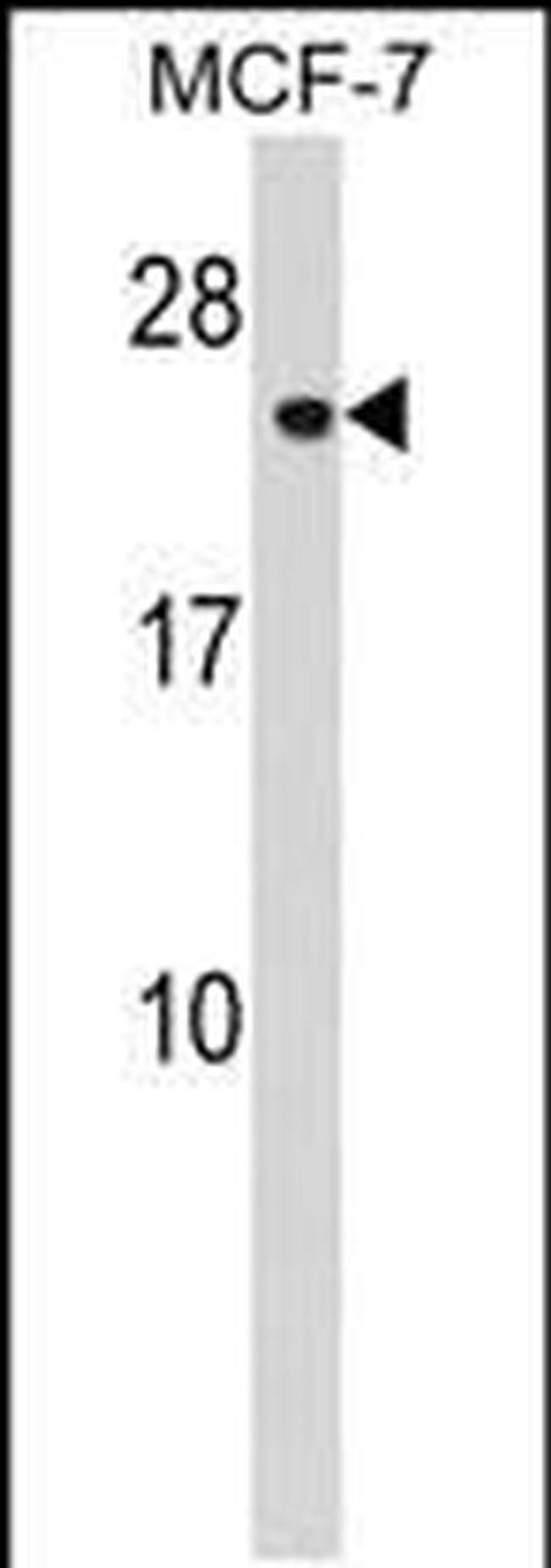 CHMP1A Antibody in Western Blot (WB)