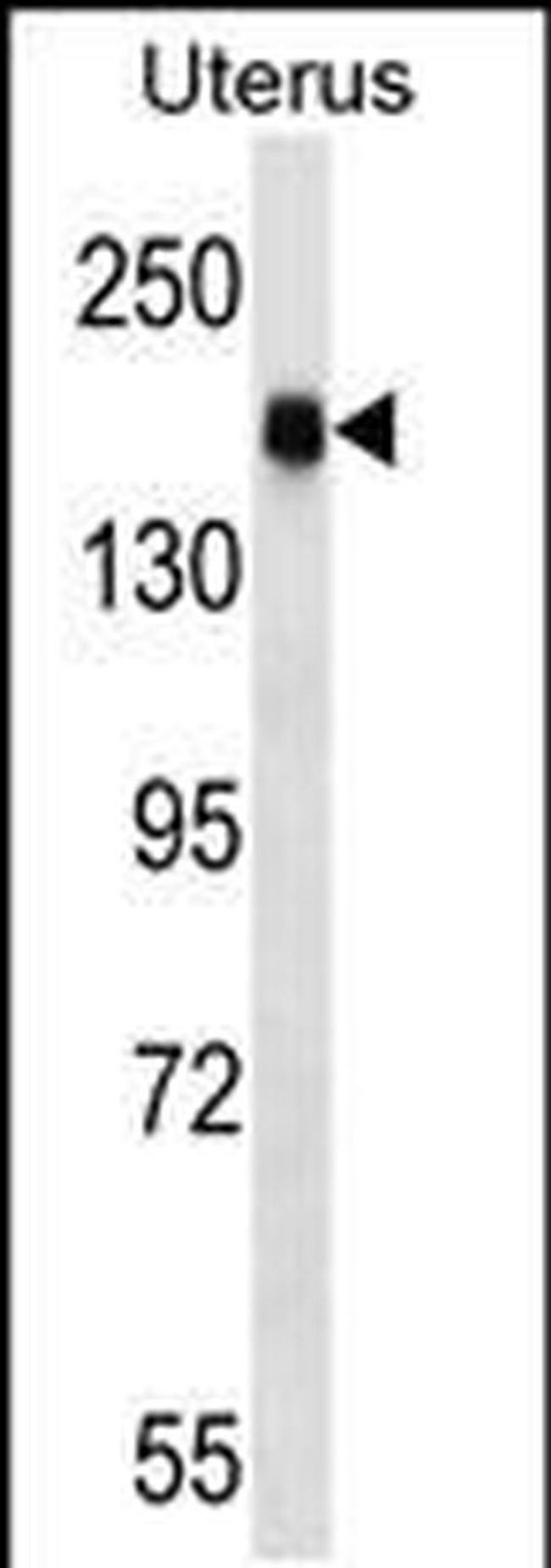 CGNL1 Antibody in Western Blot (WB)