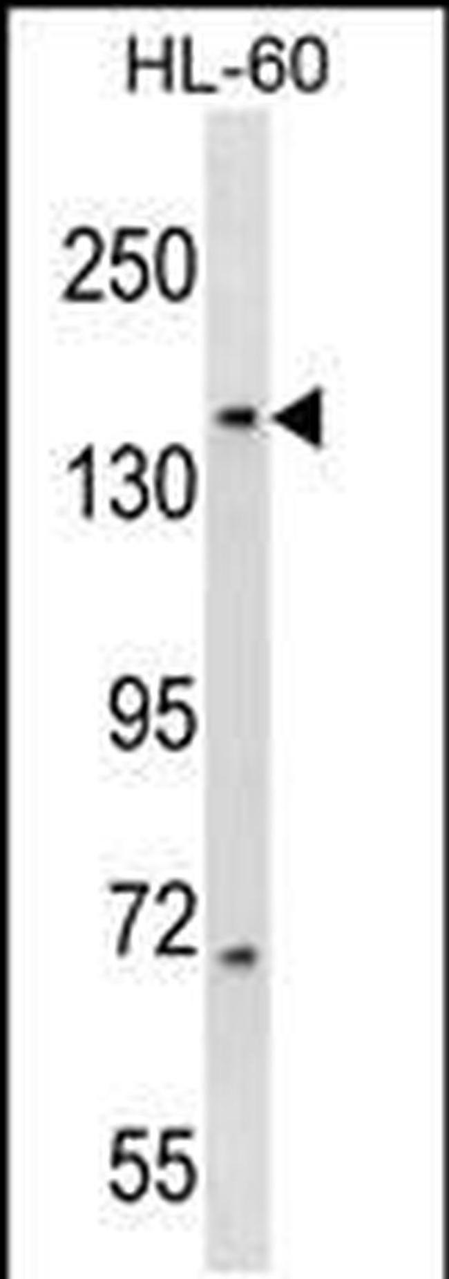 RIMBP3 Antibody in Western Blot (WB)