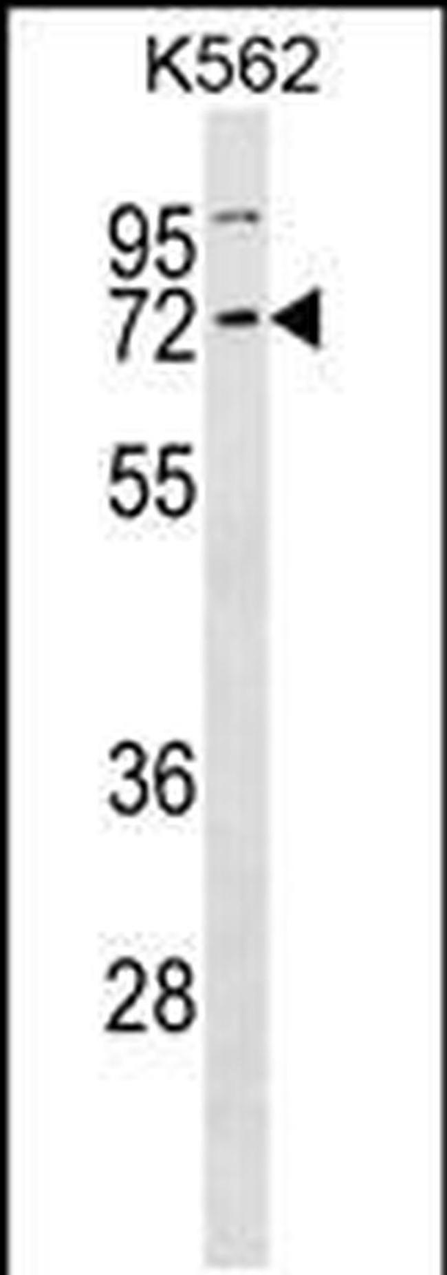 CCNK Antibody in Western Blot (WB)