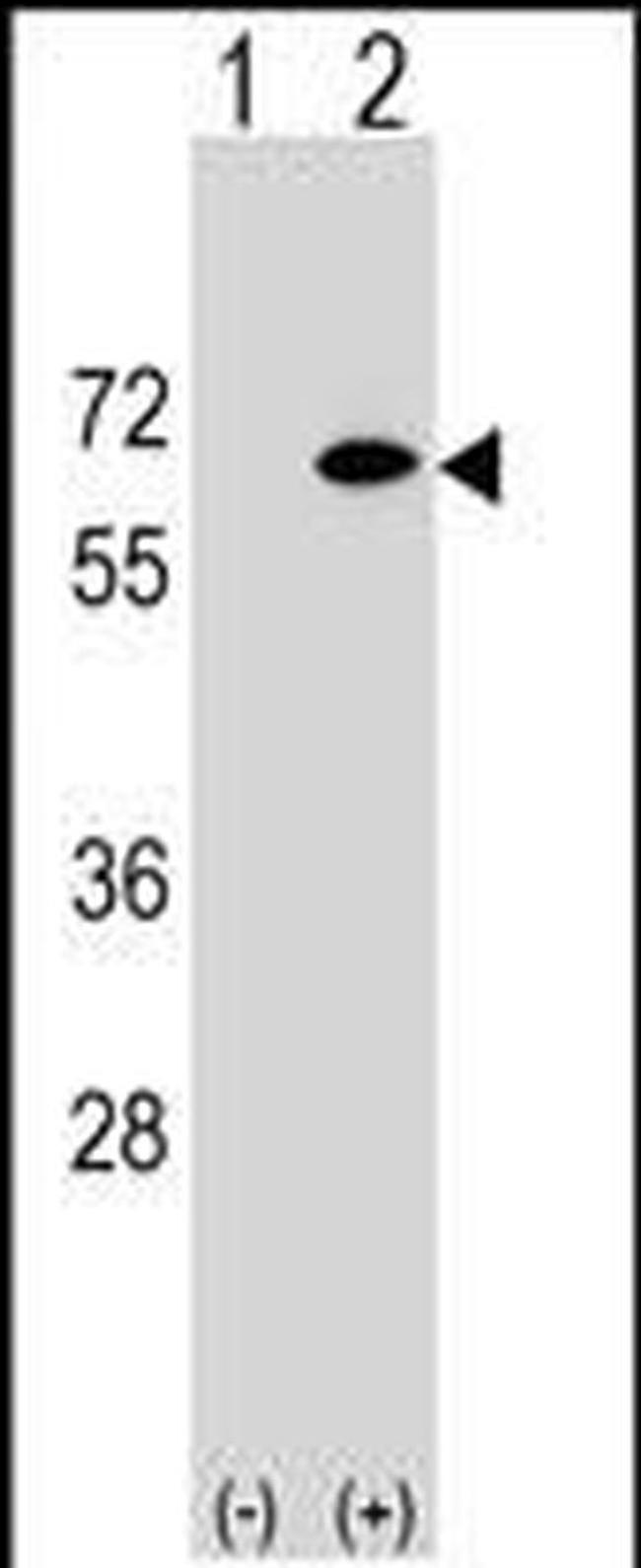 EYA2 Antibody in Western Blot (WB)