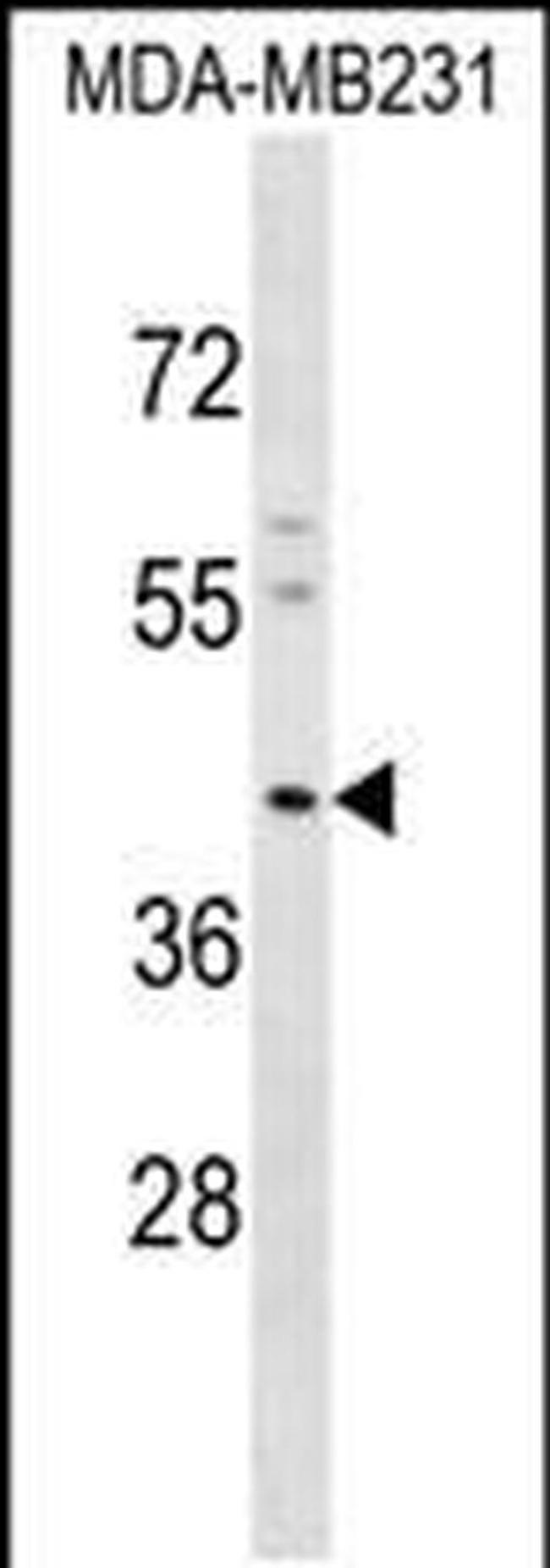 Kir4.2 (KCNJ15) Antibody in Western Blot (WB)