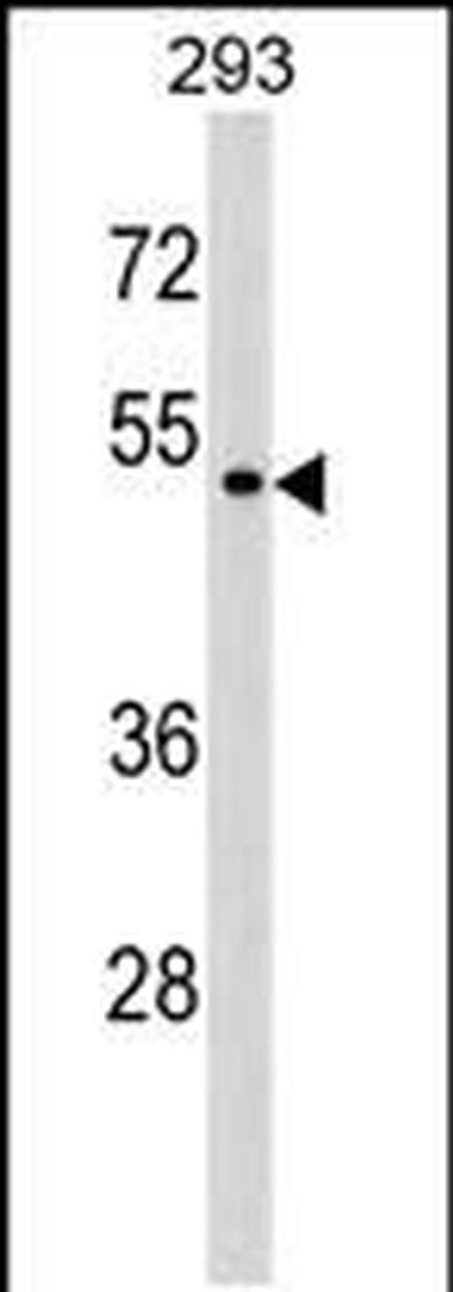 P2X6 Antibody in Western Blot (WB)