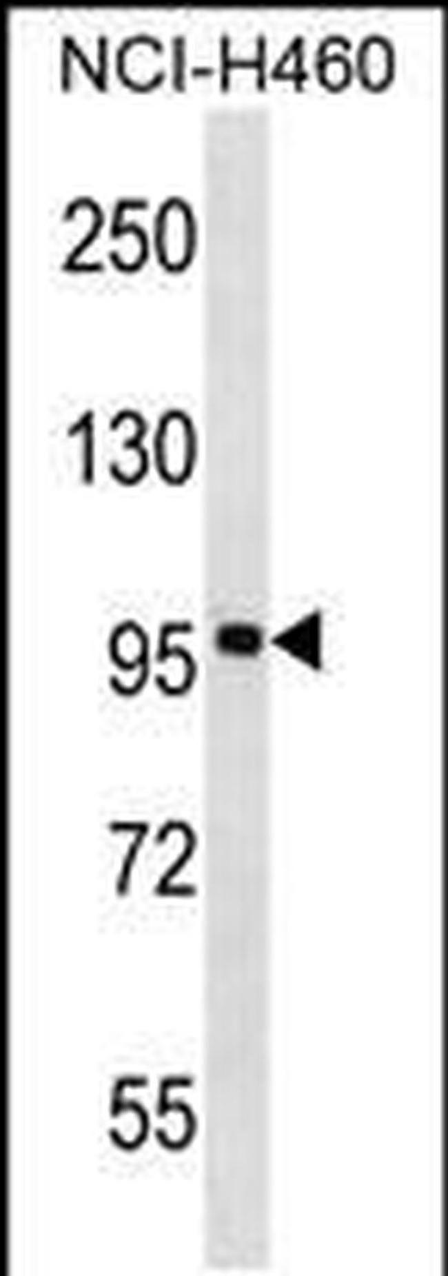 FBXL13 Antibody in Western Blot (WB)