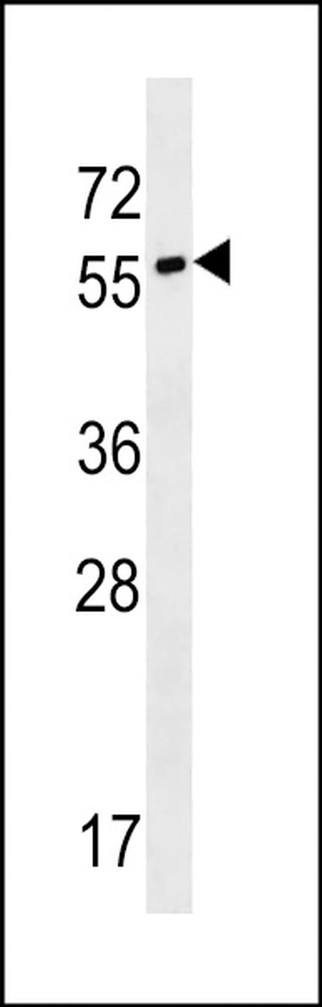 SYT17 Antibody in Western Blot (WB)