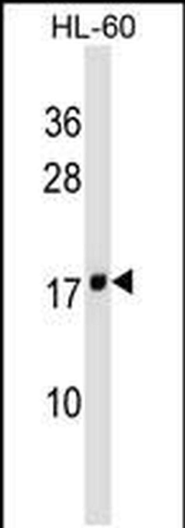 MT-ND4L Antibody in Western Blot (WB)
