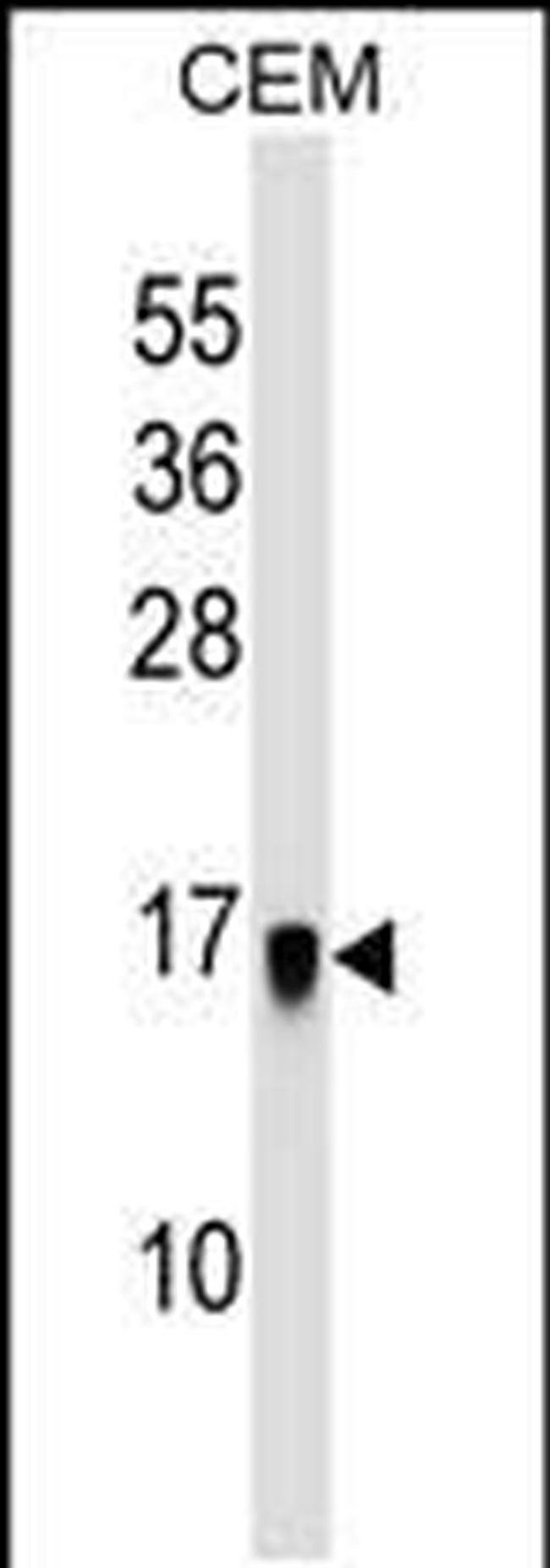 LGALSL Antibody in Western Blot (WB)