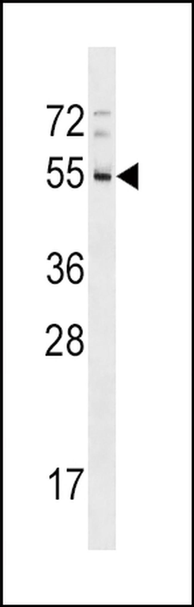 RHD Antibody in Western Blot (WB)