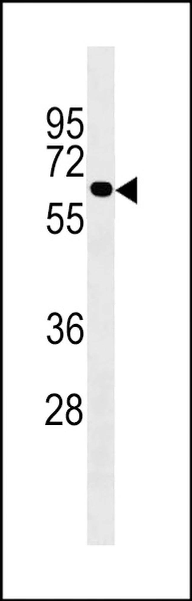 UGT2B10 Antibody in Western Blot (WB)