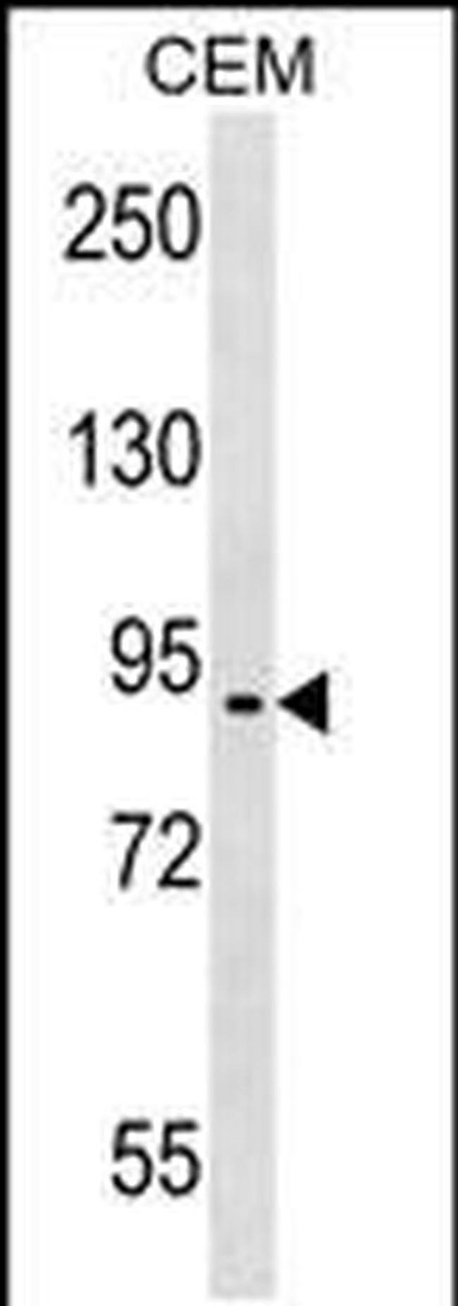 EPB41L4A Antibody in Western Blot (WB)