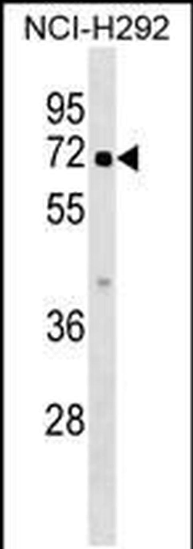 ZBTB44 Antibody in Western Blot (WB)