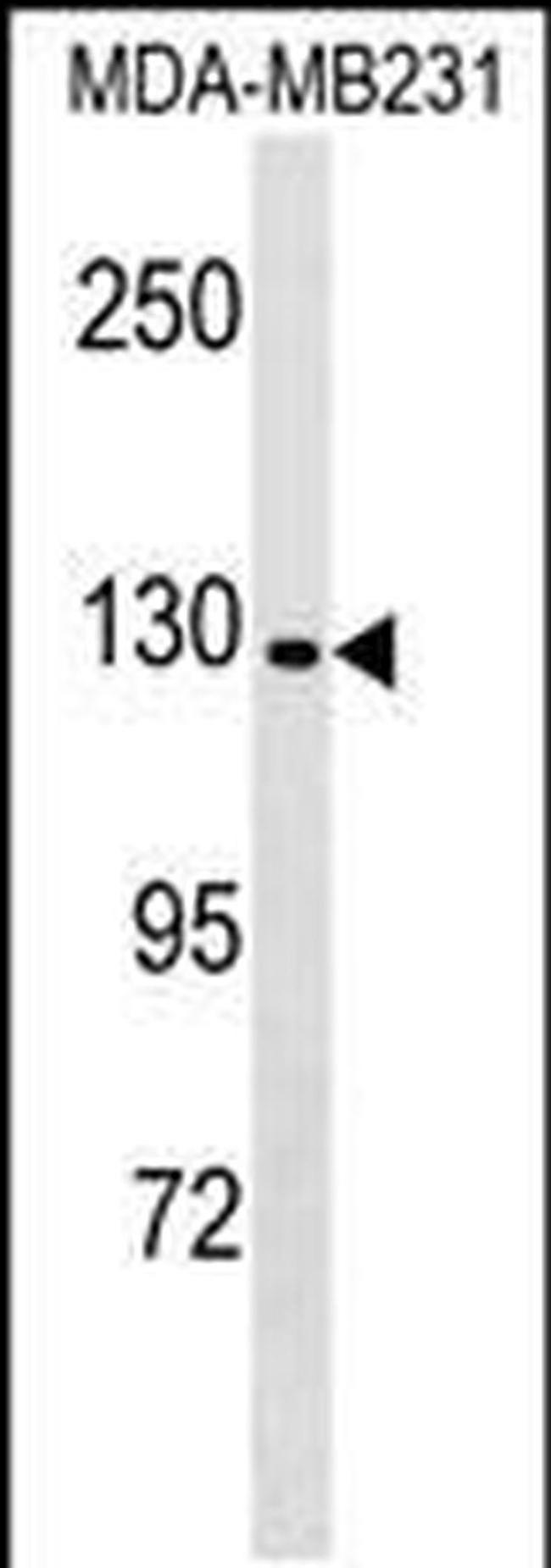 CNTNAP4 Antibody in Western Blot (WB)