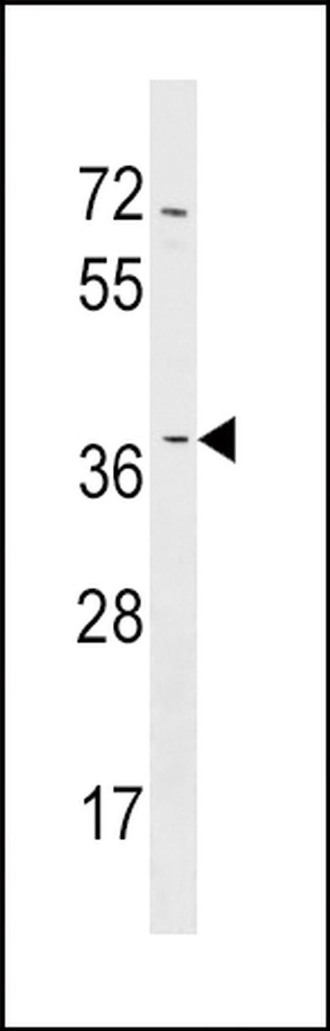 NMNAT2 Antibody in Western Blot (WB)