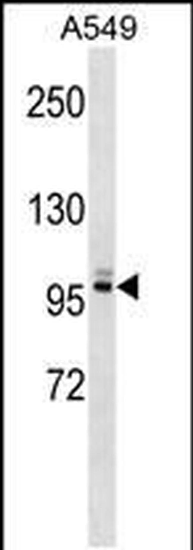 PLEKHG5 Antibody in Western Blot (WB)