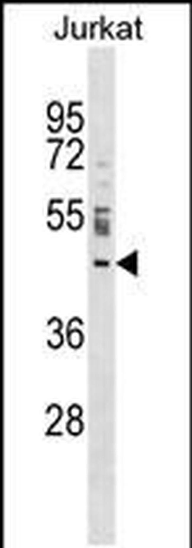 NUP43 Antibody in Western Blot (WB)