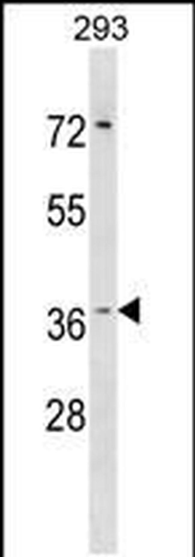 HYI Antibody in Western Blot (WB)