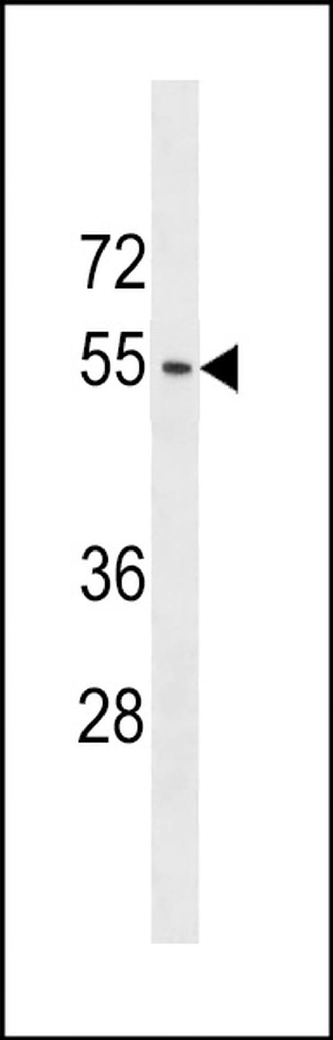 ACTL9 Antibody in Western Blot (WB)